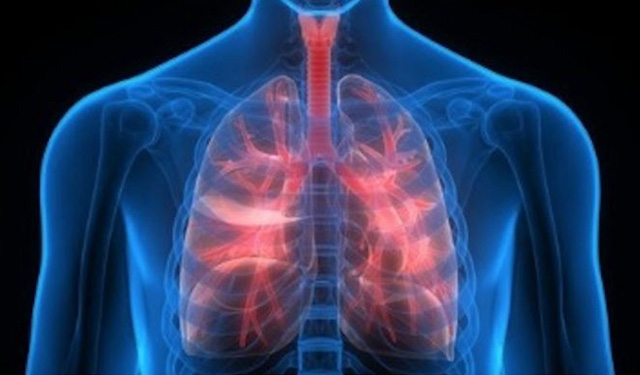 Hipertensión arterial pulmonar afecta a cuatro mujeres por cada hombre