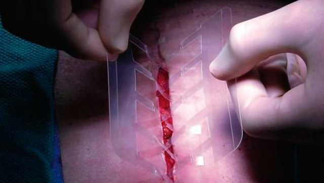 Crean cinta adhesiva que podría sustituir a suturas para cerrar heridas