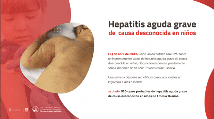 hepatitis niños UdeG